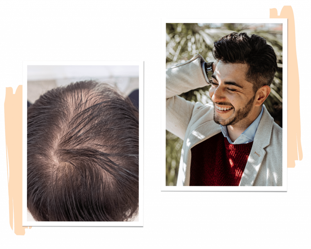 patch cutanea prima e dopo