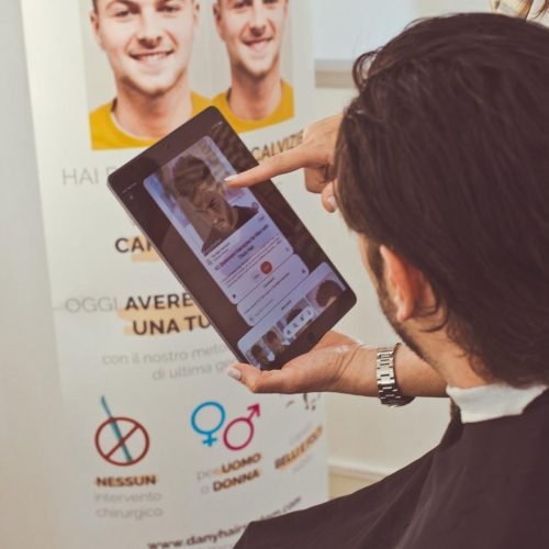 protesi capelli – alopecia – perdita di capelli protesi capelli - alopecia - perdita di capelli